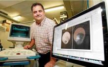 Rastrear el tumor de la mama en 3D