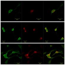 AntalGenics participa en un proyecto europeo para estudiar y tratar el dolor crónico mediante nanopartículas