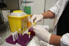 En la Semana Europea de la Lucha contra el Cáncer, ponemos en valor el trabajo diario que desarrollan algunas de las empresas del Parque Científico de la UMH