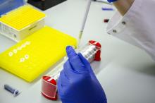 El proyecto de investigación ApoE-EA, seleccionado por Innopropel UMH, desarrolla una tecnología para el diagnóstico precoz del Alzheimer